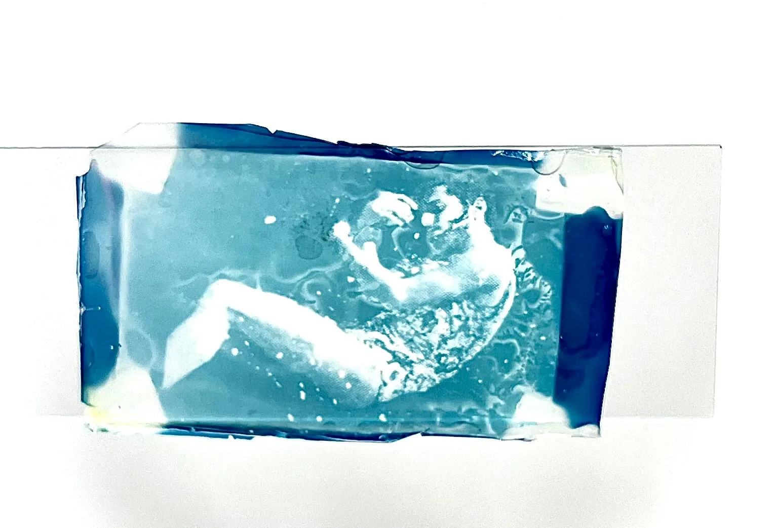 Fetus, 2024